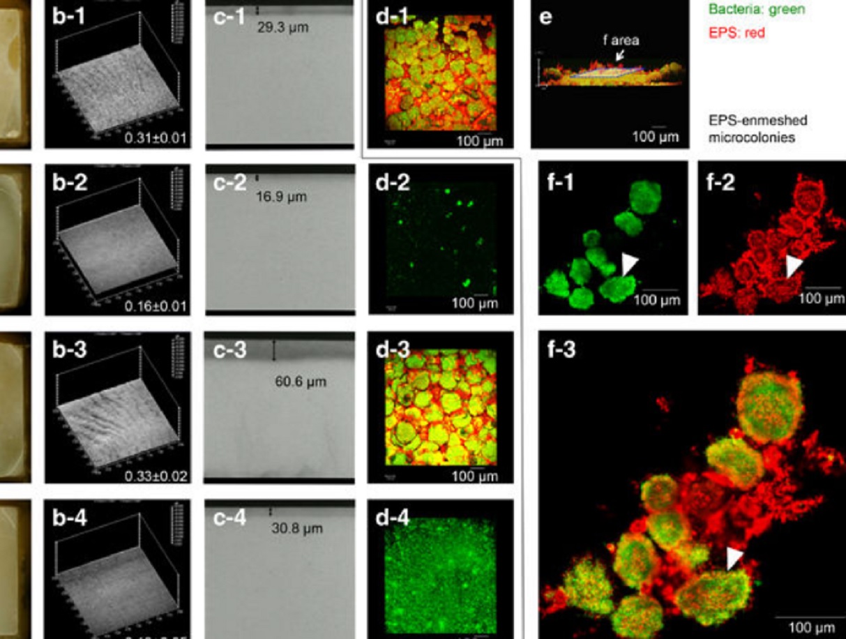 Biofilm three-dimensional architecture influences in situ pH distribution pattern on the human enamel surface