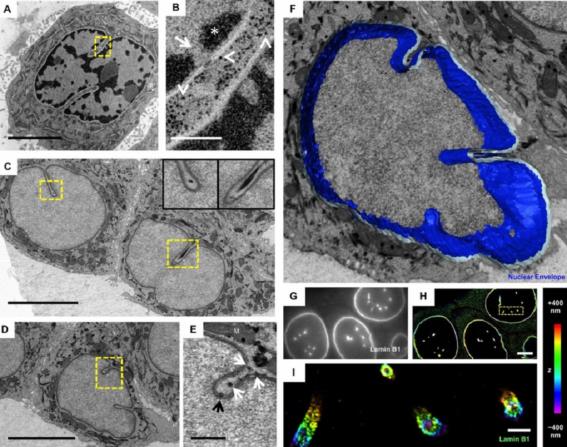 Deep nuclear invaginations are linked to cytoskeletal filaments – integrated bioimaging of epithelial cells in 3D culture