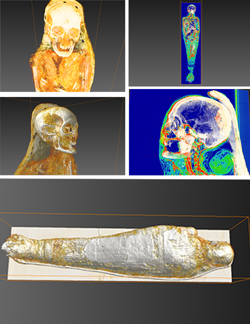 AMSC Research, LLC uses Amira software to understand processes and rituals of Egyptian mummification