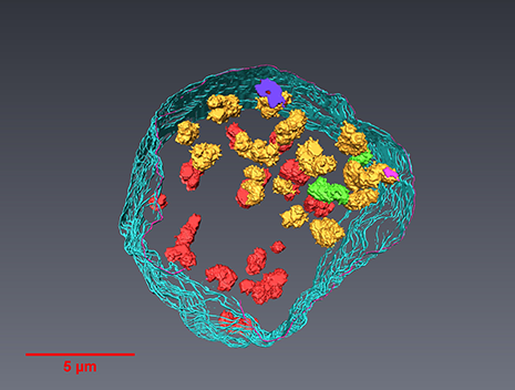The London Centre for Nanotechnology uses Avizo Software to reveal structure of human chromosomes and nucleus in 3D