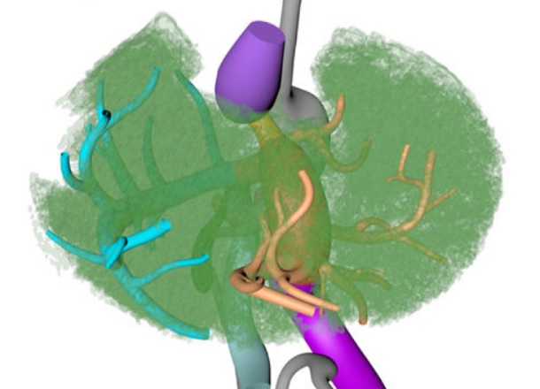 Human liver segments: role of cryptic liver lobes and vascular physiology in the development of liver veins and left-right asymmetry