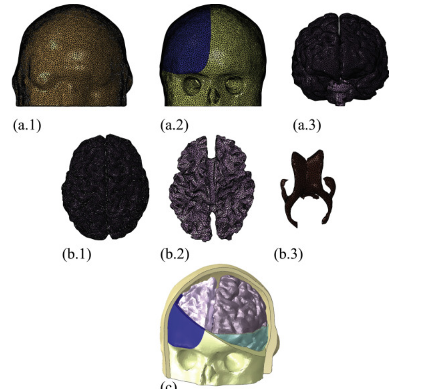 On the mechanical behaviour of PEEK and HA cranial implants under impact loading