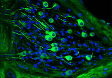 Chronic cigarette smoke exposure drives spiral ganglion neuron loss in mice