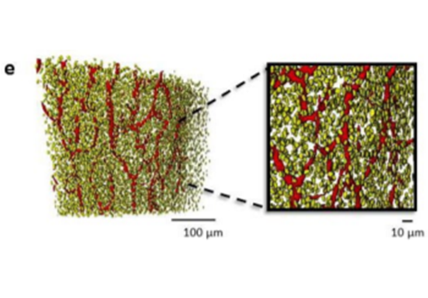 Regional diversity in the murine cortical vascular network is revealed by synchrotron X-ray tomography and is amplified with age