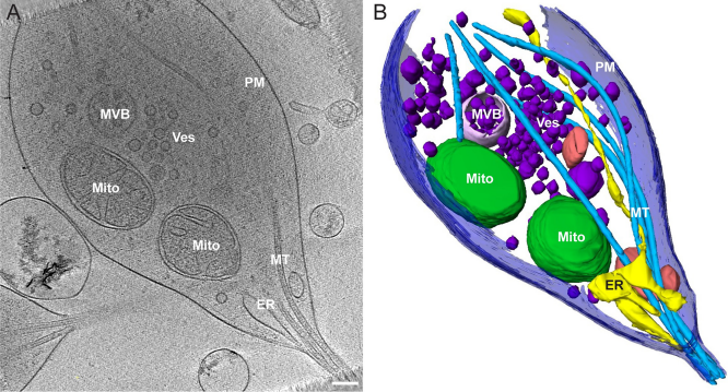 Morphology of mitochondria in spatially restricted axons revealed by cryo-electron tomography