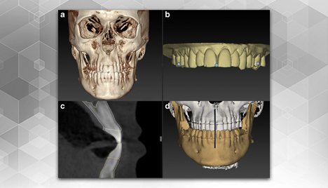 Virtual setup in orthodontics: planning and evaluation