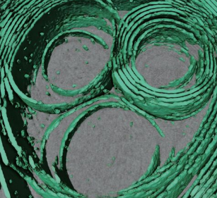 Membrane architecture of pulmonary lamellar bodies revealed by post-correlation on-lamella cryo-CLEM