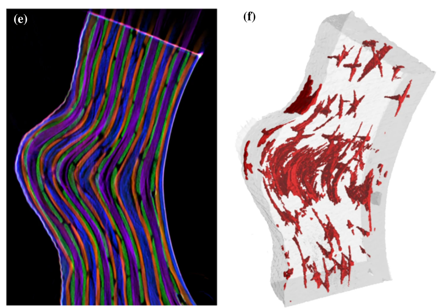 Phase-contrast and dark-field imaging for the inspection of resin-rich areas and fiber orientation in non-crimp vacuum infusion carbon-fiber-reinforced polymers