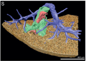Multiscale Co‐reconstruction of Lung Architectures and Inhalable Materials Spatial Distribution