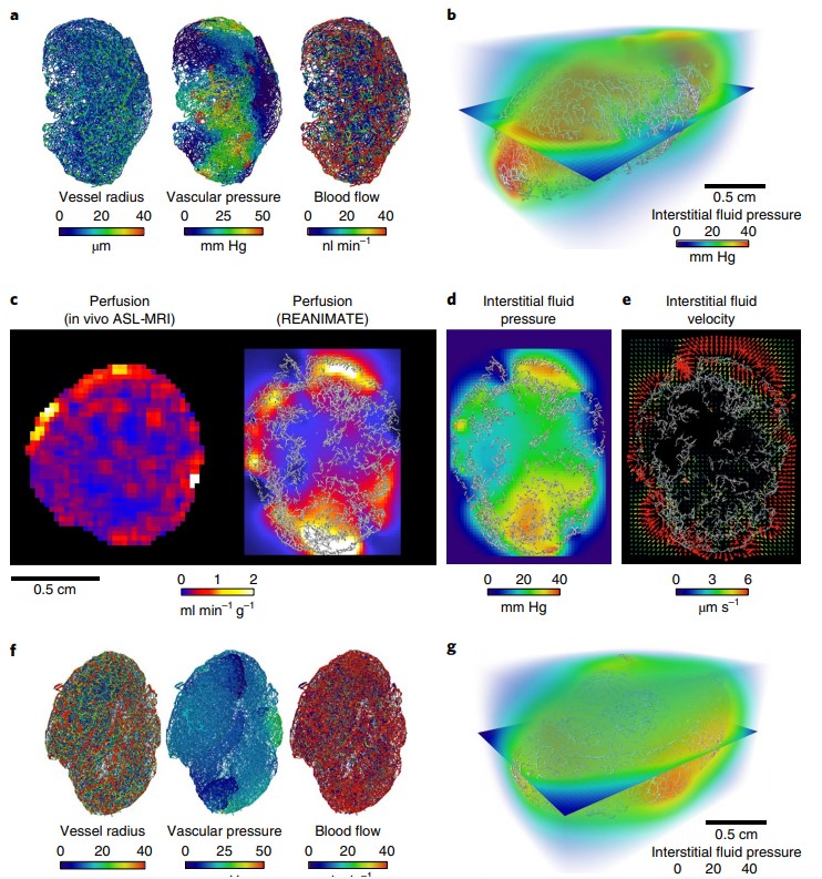Computational fluid dynamics with imaging of cleared tissue and of in vivo perfusion predicts drug uptake and treatment responses in tumours
