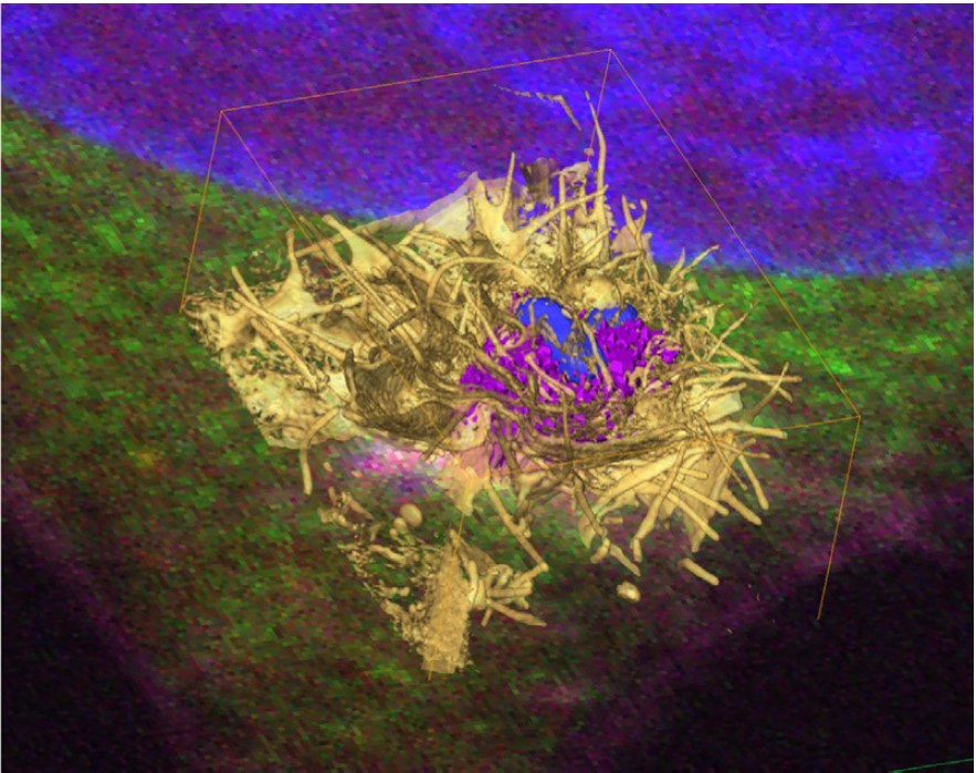 Step-by-step guide to post-acquisition correlation of confocal and FIB/SEM volumes using Amira software