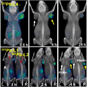 Preclinical Evaluation of 203/212Pb-Labeled Low-Molecular-Weight Compounds for Targeted Radiopharmaceutical Therapy of Prostate Cancer