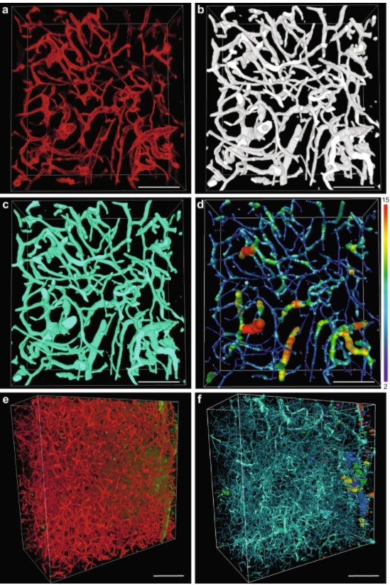 Optical tissue clearing and machine learning can precisely characterize extravasation and blood vessel architecture in brain tumors