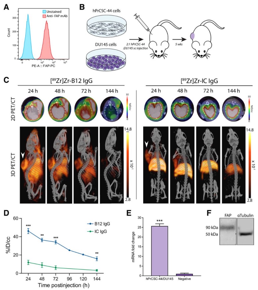Imaging Fibroblast Activation Protein Alpha Improves Diagnosis of Metastatic Prostate Cancer with Positron Emission Tomography