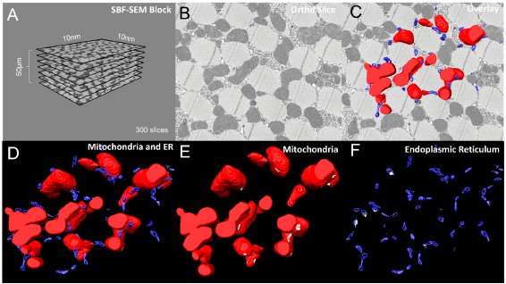 Protocols for Generating Surfaces and Measuring 3D Organelle Morphology Using Amira