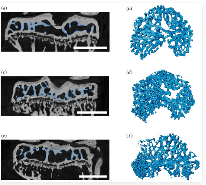 A new straightforward method for semi-automated segmentation of trabecular bone from cortical bone in diverse and challenging morphologies