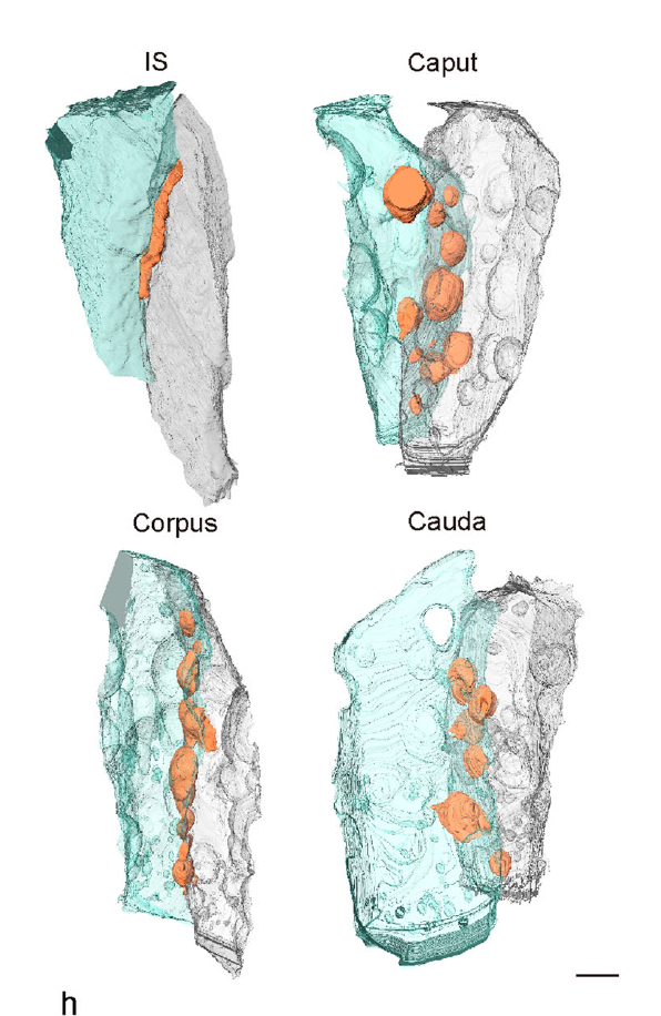 In situ architecture of the intercellular organelle reservoir between epididymal epithelial cells by volume electron microscopy